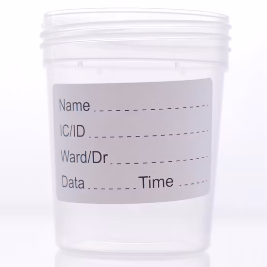 Spécimen jetable 60 ml Conteneur d'urine rouge pour l'hôpital